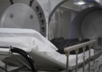 Swanson Hyperbarics Image